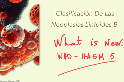 Nueva Clasificación de Neoplasias Linfoides B . WHO HAEM 5